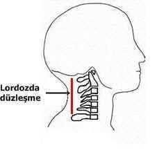 lordoz-2